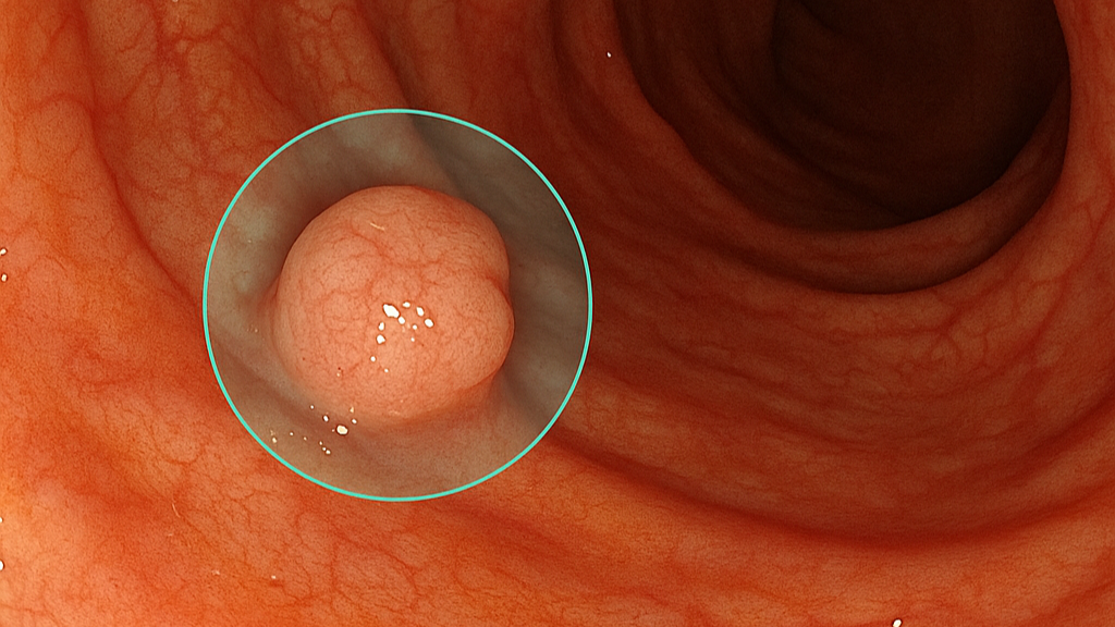 Endoscopy frame with AI overlay
